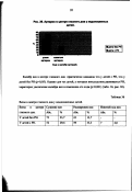 Асташева, Ирина Борисовна. Диагностика и прогнозирование активной и рубцовой ретинопатии недоношенных: дис. кандидат медицинских наук: 14.00.08 - Глазные болезни. Москва. 2002. 205 с.