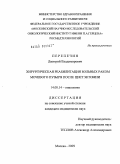 Перепечин, Дмитрий Владимирович. Хирургическая реабилитация больных раком мочевого пузыря после цистэктомии: дис. кандидат медицинских наук: 14.00.14 - Онкология. Москва. 2009. 163 с.