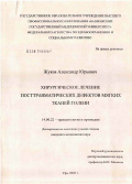 Жуков, Александр Юрьевич. Хирургическое лечение посттравматических дефектов мягких тканей голени: дис. кандидат медицинских наук: 14.00.22 - Травматология и ортопедия. Уфа. 2005. 156 с.