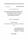 Хасан, Самер Халиль Мохаммад. Методы дипольной электрокардиотопографии и ЭКГ высокого разрешения в оценке электрического ремоделирования миокарда у больных с острым коронарным синдромом: дис. кандидат медицинских наук: 14.00.06 - Кардиология. Москва. 2005. 138 с.