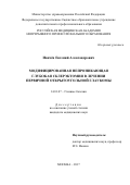 Ивачёв, Евгений Александрович. Модифицированная непроникающая глубокая склерэктомия в лечении первичной открытоугольной глаукомы: дис. кандидат наук: 14.01.07 - Глазные болезни. Москва. 2017. 143 с.