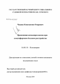 Чахава, Константин Отарович. Применение антидепрессантов при соматоформном болевом расстройстве: дис. кандидат медицинских наук: 14.00.18 - Психиатрия. Москва. 2004. 157 с.