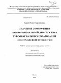Есаян, Нуне Карленовна. Значение эхографии в дифференциальной диагностике тубоовариальных образований неопухолевой этиологии: дис. кандидат медицинских наук: 14.00.19 - Лучевая диагностика, лучевая терапия. Обнинск. 2009. 155 с.